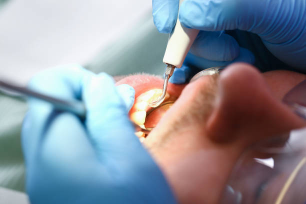 Best Urgent Tooth Repair  in Luther, OK